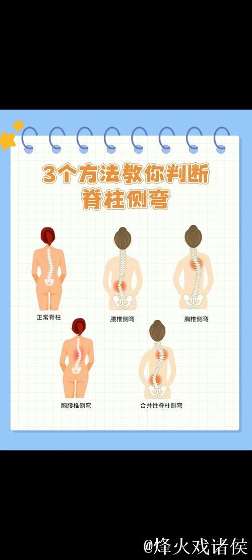 1分钟科普站丨预防青少年脊柱侧弯 这2个动作太管用了